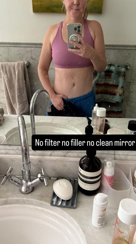 Amy Schumer