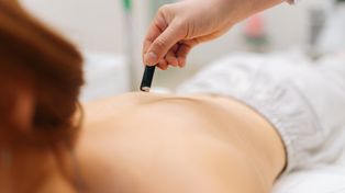 What is moxibustion? What does moxa involve?