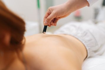 What is moxibustion? What does moxa involve?