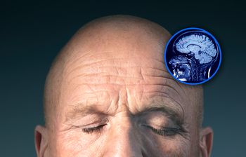 Sprawili, że mózg stał się przezroczysty. Naukowcy: To pierwszy raz