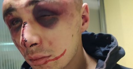Morąg. Brutalne pobicie i napad na dworcu. Matka apeluje do świadków