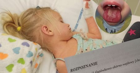 Koronawirus u dzieci. 2,5 latka wymiotowała i miała owrzodzenie na języku. "Ze szpitala wyszliśmy z diagnozą: PIMS o fenotypie Kawasaki"