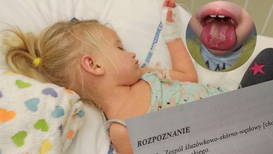 U Amelki rozwinął się zespół PIMS o fenotypie choroby Kawasakiego