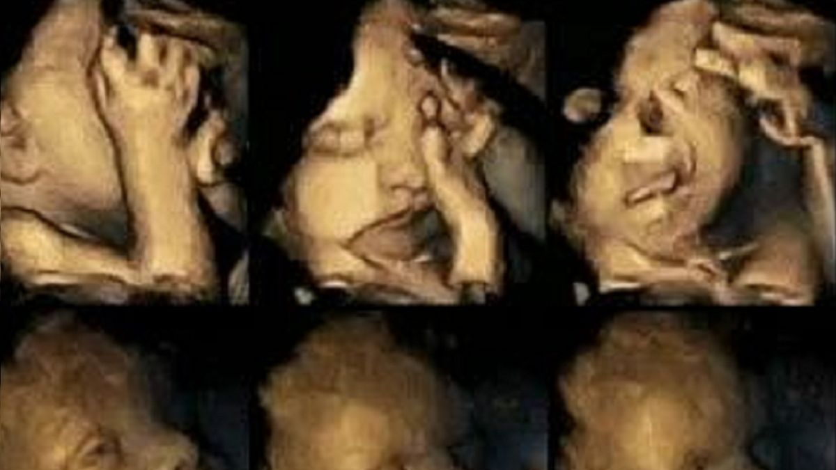 Zdjęcia USG dzieci, których matki paliły.