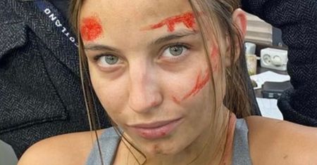 Julia Wieniawa odpowiada fance, która sugeruje jej... operację plastyczną. "Jak ludzie czasem mają MAŁO W GŁOWIE"