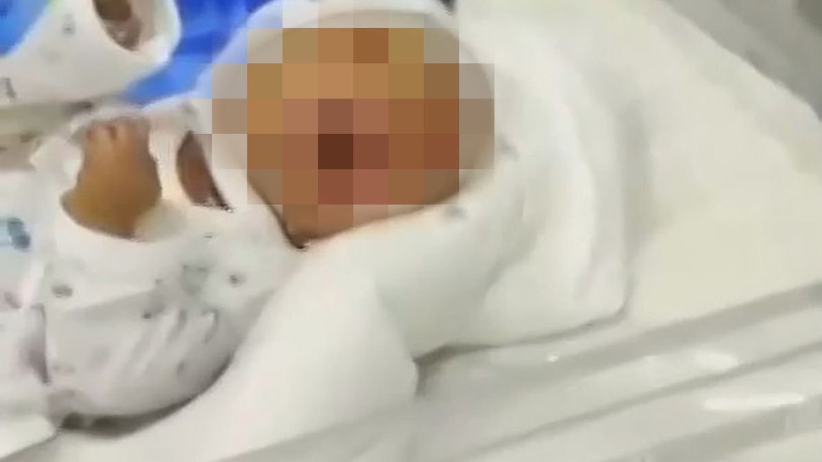 Niemowlę przyszło na świat z koszmarnymi wadami genetycznymi