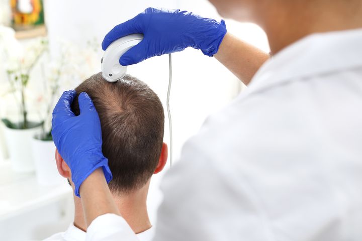 Grzybica woszczynowa to jedna z odmian infekcji grzybiczych skóry owłosionej głowy.