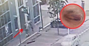 Absurd w Ostrołęce. Potrąciła go hulajnoga, ma zapłacić mandat