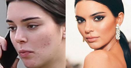 Kendal Jenner twarzą kosmetyków na trądzik. Fani: "Chyba sobie żartujesz! To żałosny płacz dla odrobiny uwagi"