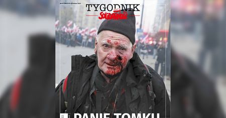 Tomasz Gutry kontra policja. Raniony fotoreporter będzie żądał odszkodowania