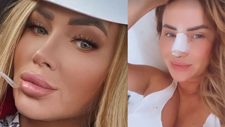 Izabela Macudzińska z "Królowych życia" pozuje z opatrunkiem na nosie