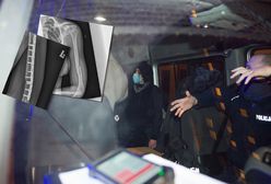 Złamana ręka podczas interwencji policji. Jest decyzja śledczych