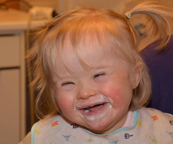 Alba ma zespół Downa