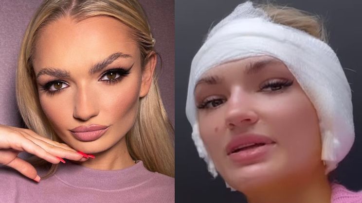 Aleksandra Daniel z "Love Island" relacjonuje operację PIERSI I USZU