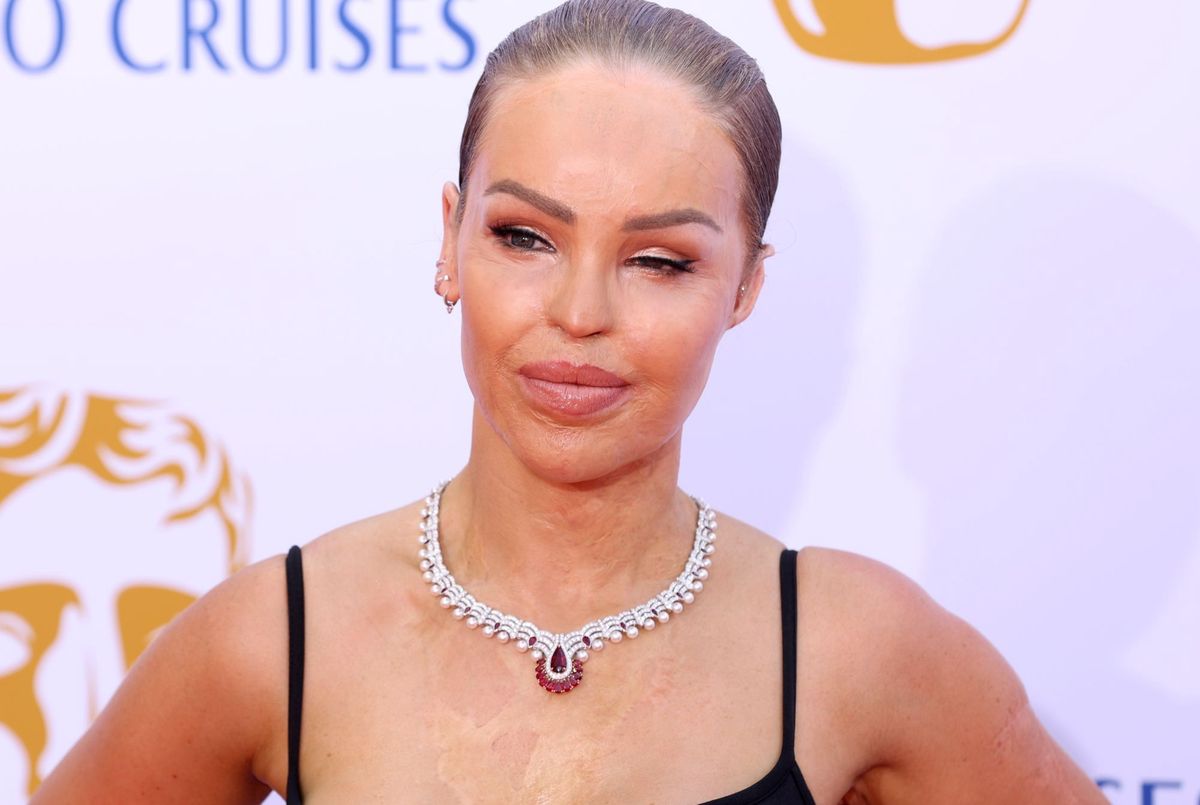 Katie Piper wyglądała pięknie na gali BAFTA 2024