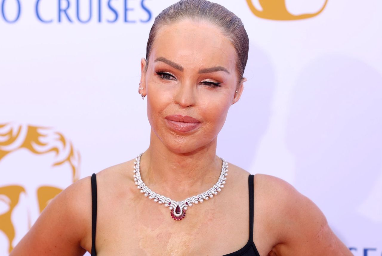 Katie Piper looked beautiful at the BAFTA 2024 gala.