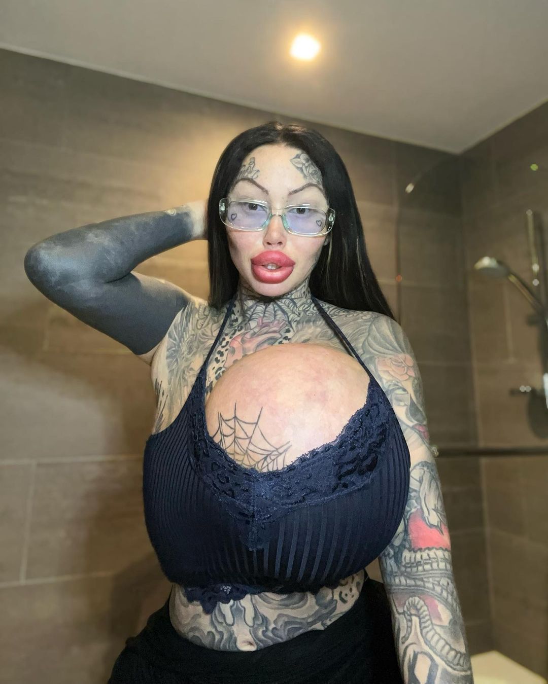 Instagramowej modelce wybuchł implant piersi. Ważył 10 kg