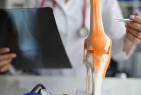 Osteoliza – przyczyny, objawy, diagnostyka i leczenie