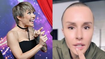 Chirurgiczna weteranka Blanka Lipińska chwali się NOWYMI USTAMI. "Nie każdy się tak świetnie goi jak ja". Zadrościcie? (FOTO)