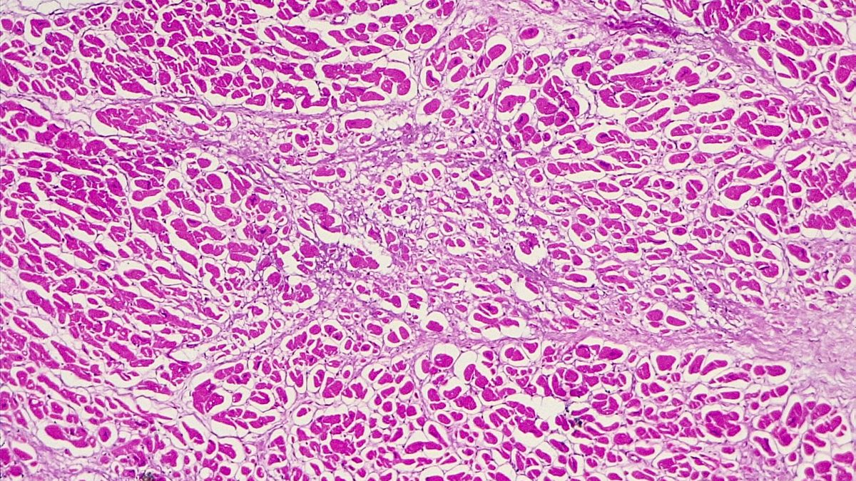 Mięsień serca pod mikroskopem