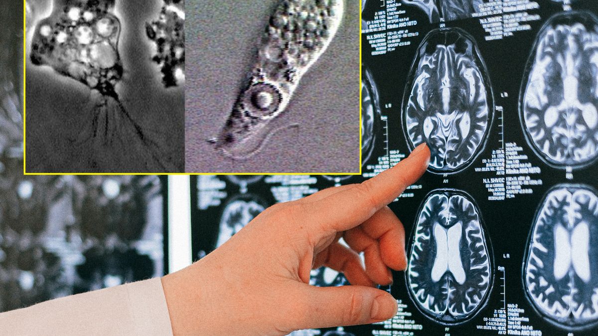 Mężczyzna zmarł po zakażeniu.