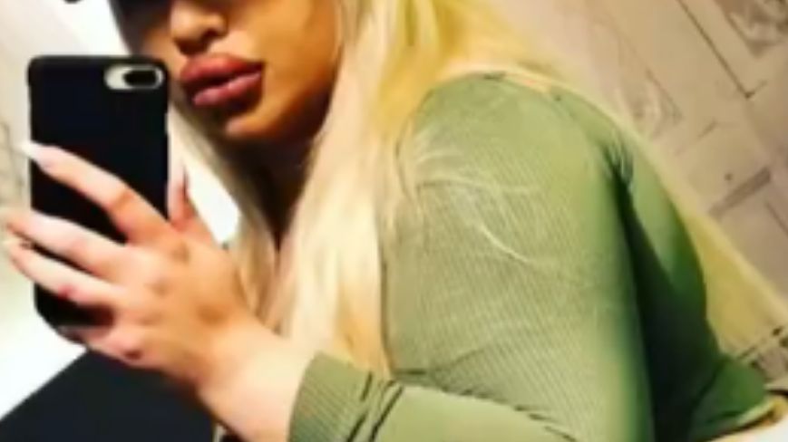 Natasha Crown wydała 110 000 funtów na pięć operacji pewnej części ciała 