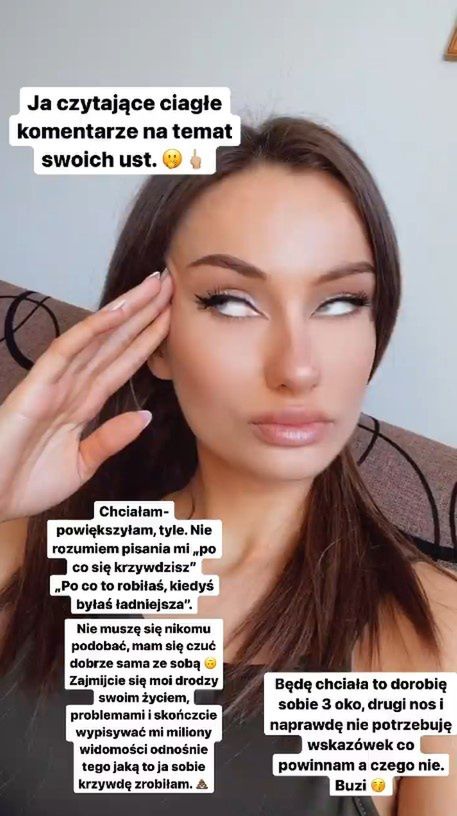 Olga z "Top Model" powiększyła usta