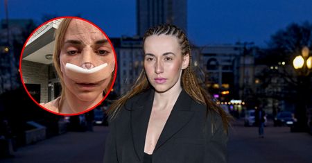 Marianna Schreiber zoperowała nos. "Mój mąż był temu przeciwny"