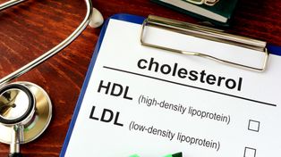 Cholesterol po 50. roku życia. Uważaj na te błędy. Mogą poważnie pogorszyć stan twojego zdrowia