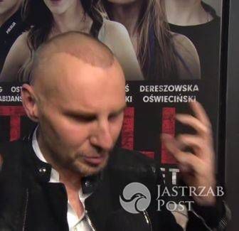 Krzysztof Gojdź po przeszczepie włosów