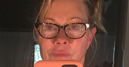 Melanie Griffith pokazała zdjęcie po operacji. Miała raka