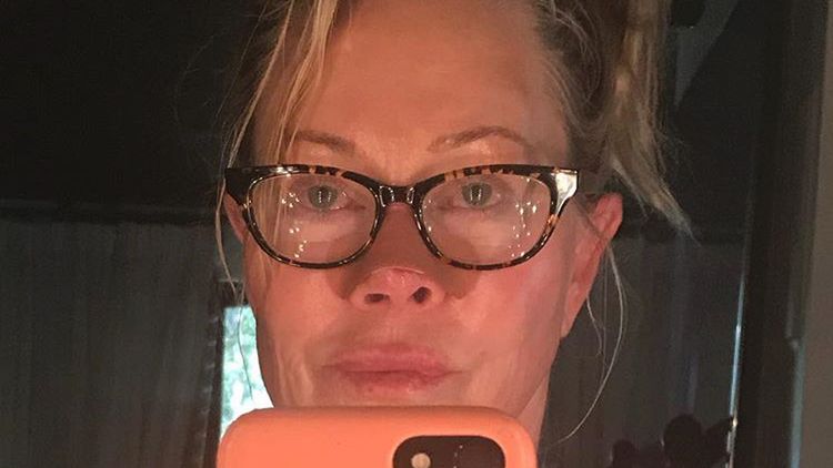 Melanie Griffith nie boi się mówić o chorobie