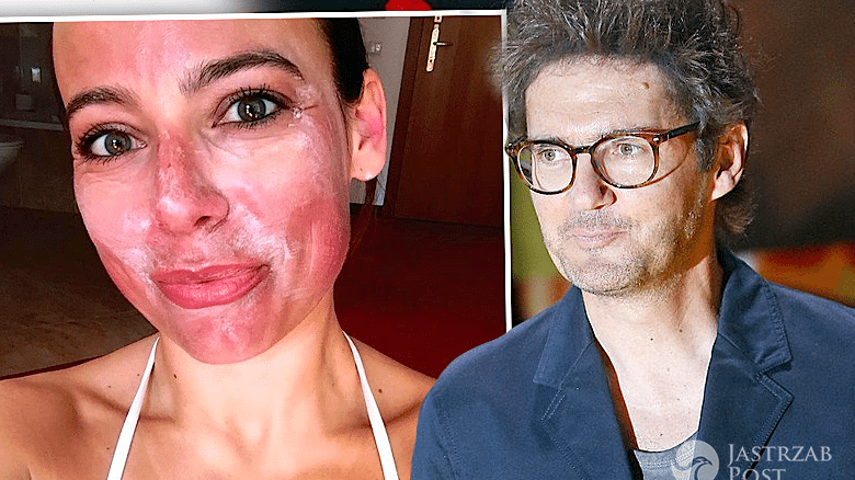 Kuba Wojewódzki wyśmiał selfie poparzonej Anny Muchy