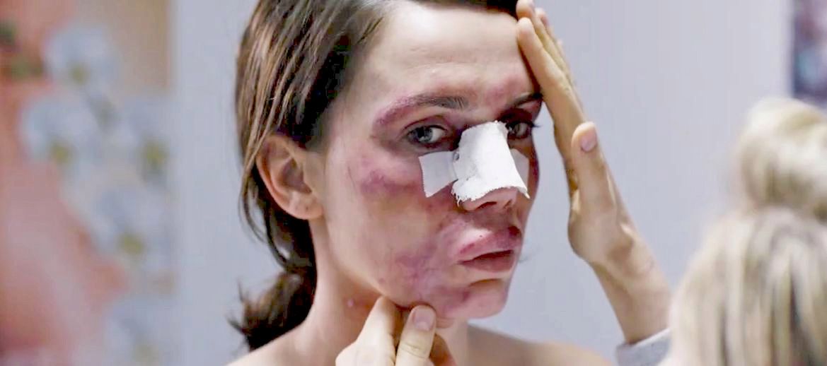 Twórcy filmu "Botoks" nie mają powodów do radości