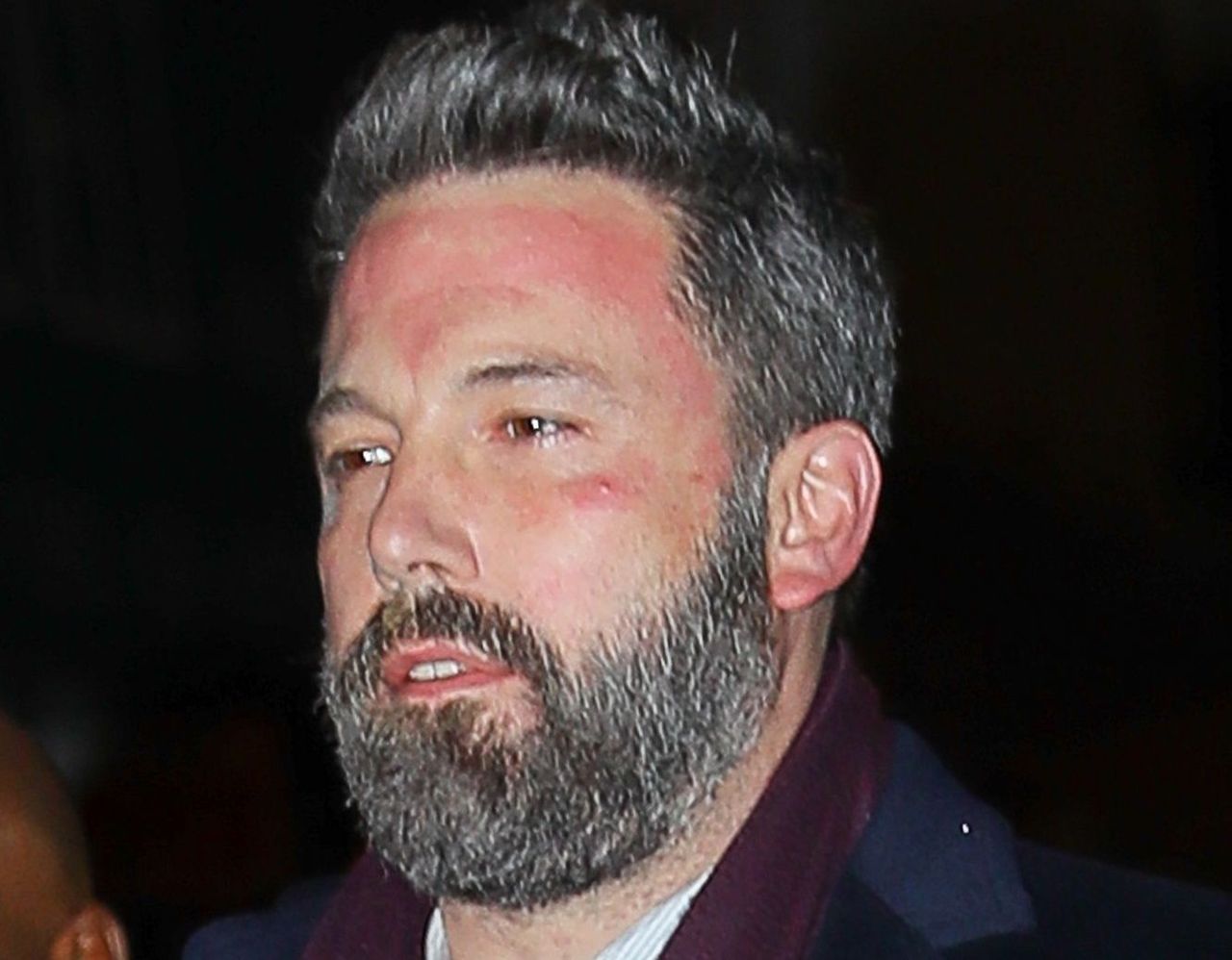 Ben Affleck znowu trafił na odwyk. To już trzeci raz w tym roku