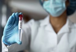 Ebola znów atakuje. Wykryto przypadki zachorowań.