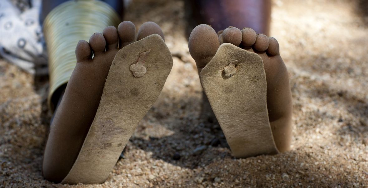 Angola, południowa Afryka. Dziewczynka w zbyt małych klapkach 
