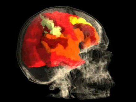 Tak wygląda kobiecy mózg w czasie orgazmu