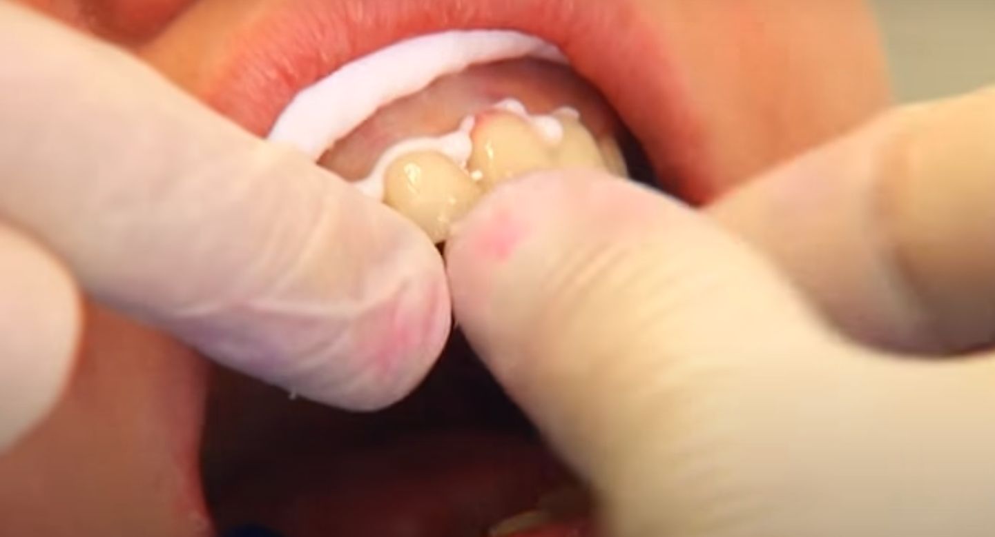 Uczestniczka w trakcie metamorfozy (fot. YouTube)