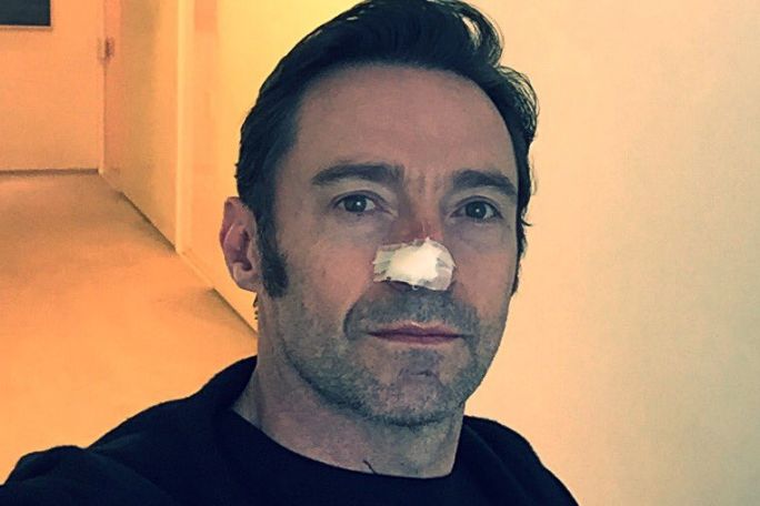 Hugh Jackman ma nawrót raka skóry, czy i tym razem wyjdzie obronną ręką?