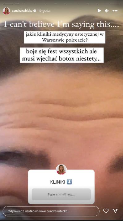 Sandra Kubicka pokazała zmarszczki