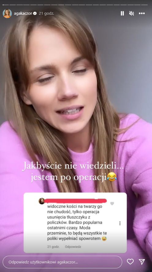 Agnieszka Kaczorowska o operacji twarzy
