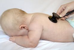 Roczny chłopiec ważył 5 kg. Był na diecie wegańskiej