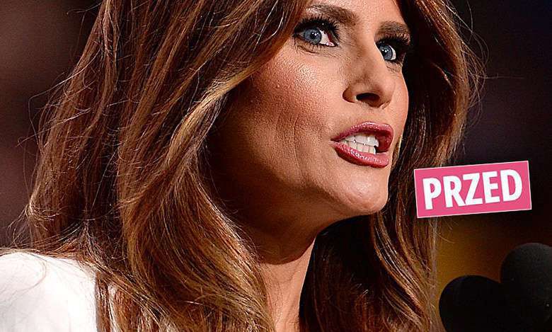 Melania Trump została blodnynką! Nowa fryzura odjęła jej lat! Wspaniała zmiana