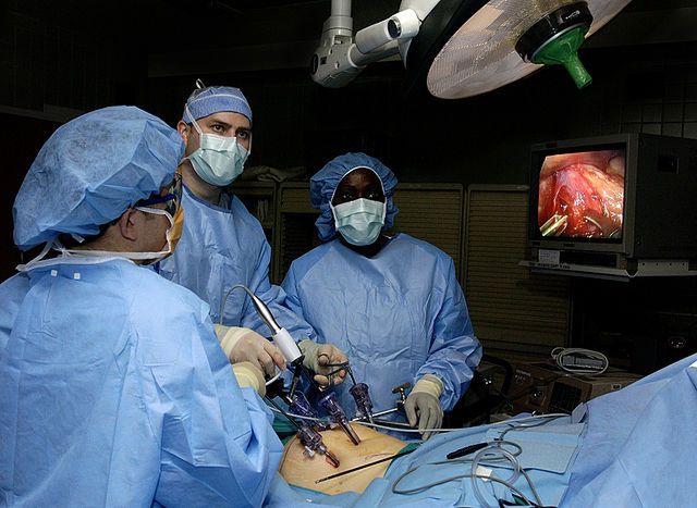 Wykorzystanie laparoskopii w czasie operacji żołądka 
