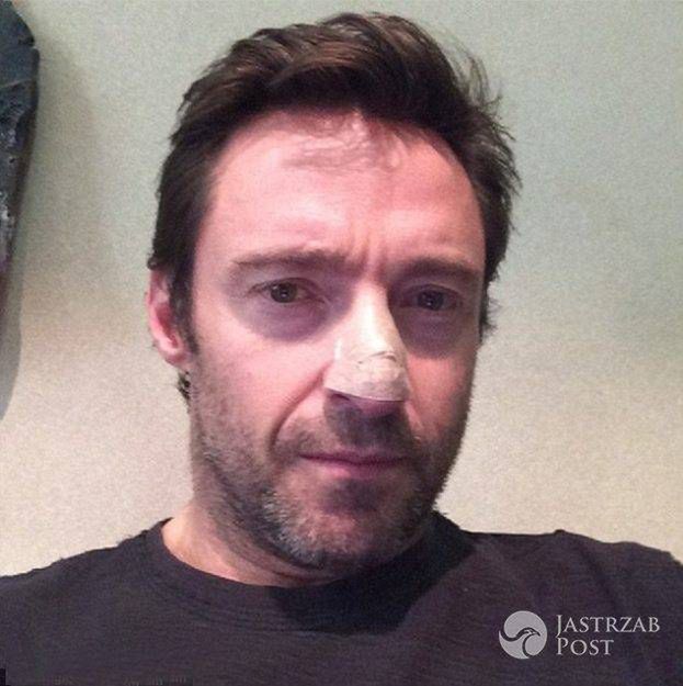 Hugh Jackman wygrał z rakiem skóry. Był trzykrotnie operowany