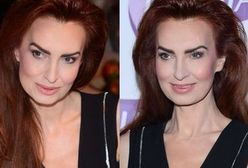 Agnieszka Maciąg: co się stało z jej twarzą?!