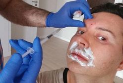 Michał Witkowski powiększył sobie usta!