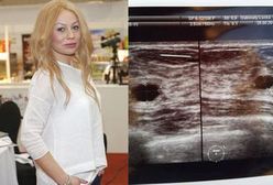 Monika Jarosińska pokazała badanie piersi!