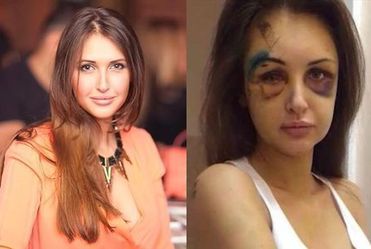 Modelka skatowana przez rosyjskiego milionera!